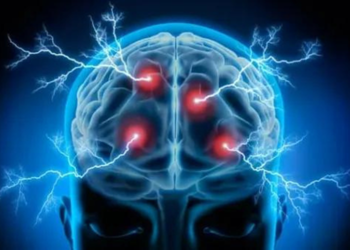 Transcranial Magnetic Stimulation